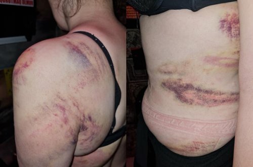 Arvadını bıçaqlayaraq öldürən şəxs barədə RƏSMİ AÇIQLAMA