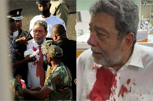 Karib ölkəsinin baş nazirini vaksinə qarşı etiraz aksiyasında yaraladılar - FOTO/VİDEO