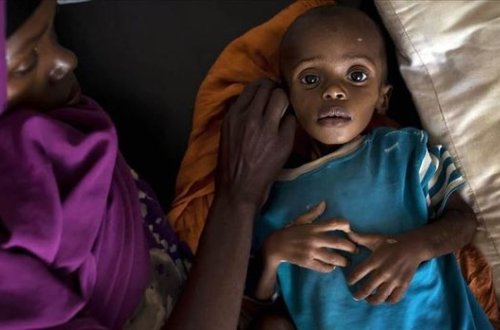 Nigeriyada koronavirusla yanaşı vəba bəlası: 60 nəfər həyatını itirib