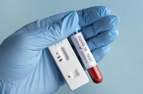 Gürcüstanda şok: son sutkada 6 minə yaxın yoluxma, 54 ölüm