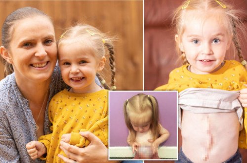 Bu qızın bağırsaqları anadangəlmə bayırdadır - FOTOLAR