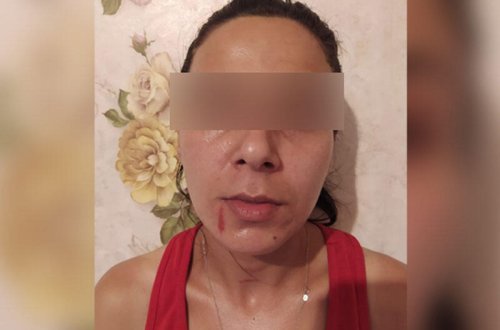 Döyülmüş fotosu yayılan qadının əri saxlanıldı