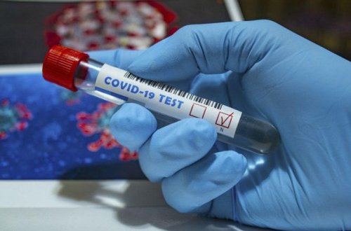 Ermənistanda COVID-19-a yoluxanların sayı 233797-yə çatıb