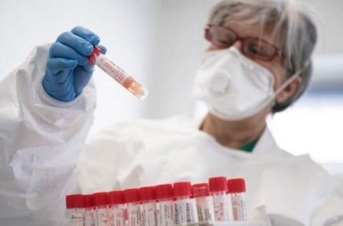 Azərbaycanda bir gündə 16 nəfər koronavirusdan öldü - FOTO