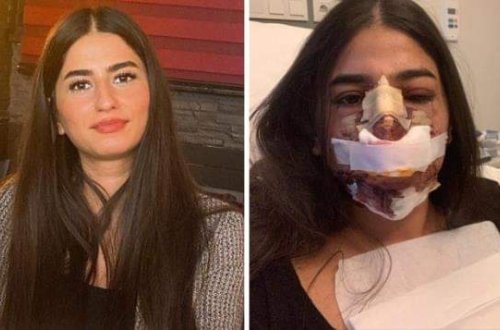 Gənc qızı tanınmaz hala salan cərrah onu lağa qoydu - FOTO