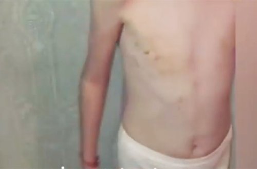 Ağstafada 8 yaşlı qızı ögey anası döyüb?