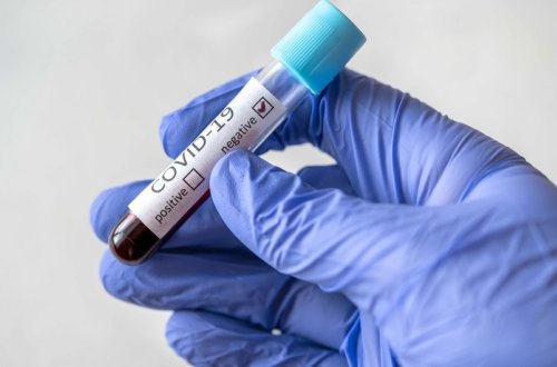 Azərbaycanda koronavirusa yoluxma əmsalı üç dəfədən çox artıb - RƏSMİ