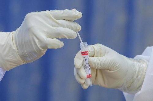 Hazırda Azərbaycanda yayılan virus “Delta” ştammıdır - RƏSMİ