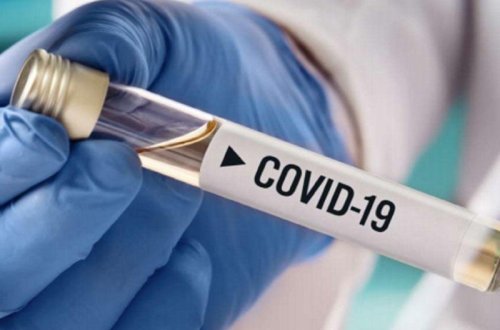 Gürcüstanda son sutkada COVID-19-dan 60 nəfər ölüb