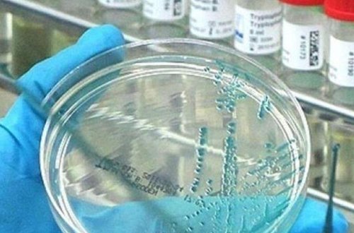 Koronanın mənşəyi ilə bağlı hesabat hazırlandı