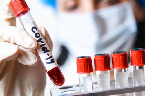 Rusiyada COVID-19-a yoluxanların sayı 180 mini ötüb