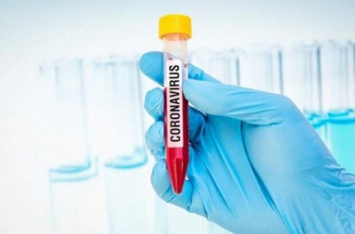 Tokio-2020-də 219 nəfər koronavirusa yoluxub