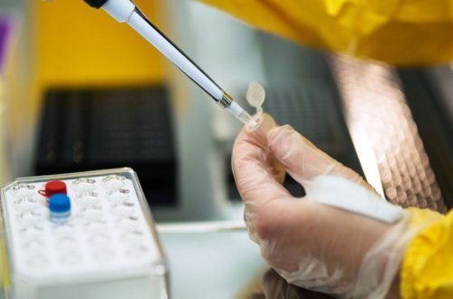 Ermənistanda daha 383 nəfər COVID-19-a yoluxub