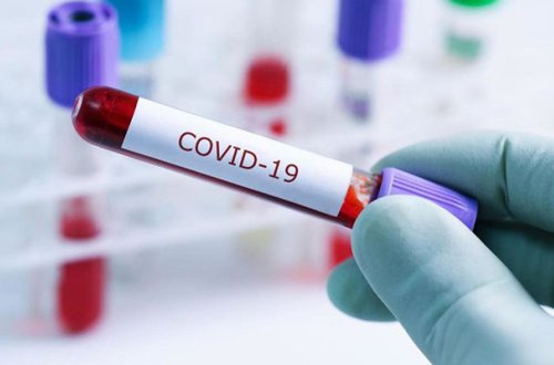 İranda 100 mindən çox tibb bacısı COVID-19-a yoluxub