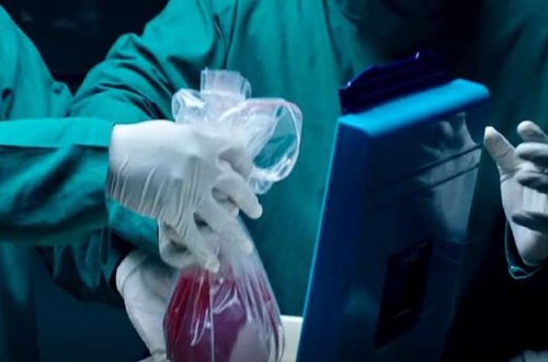 Sabiq icra başçısının adı orqan alverində - Bir böyrək 30 min manata