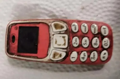 Əməliyyat olunan şəxsin mədəsindən 