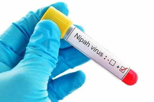 Yeni virus yayıldı - Xəstələnlərin 75 %-ə qədəri ölür