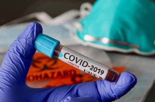 Azərbaycanda koronavirusa ən çox yoluxma hansı ərazilərdədir? - SİYAHI + FOTO