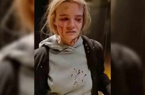 Liftdə qalan qadın ölümdən son anda döndü - VİDEO