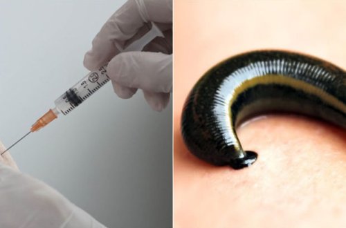 Vaksini bədəndən “təmizləmək” mümkündür?