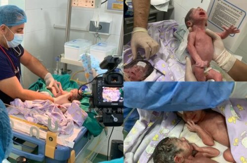 Bakıda dördəm doğulub