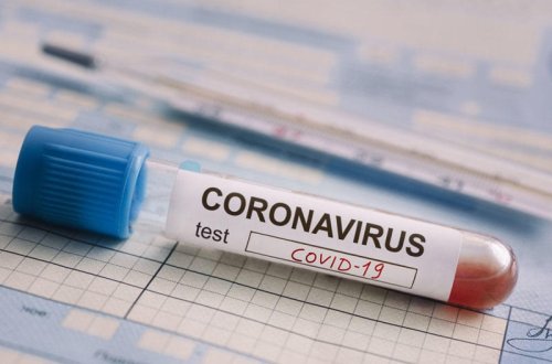 Qazaxıstanda koronavirusa daha 2 930 nəfər yoluxub