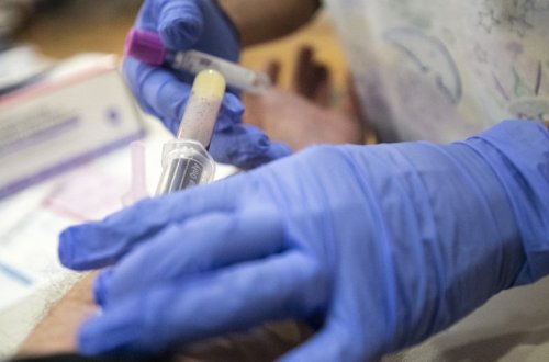 Dünyada koronavirusa yoluxma sayında azalma müşahidə olunur