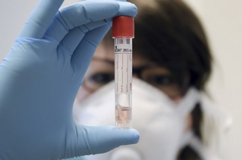 Gürcüstanda son sutkada COVID-19-dan 52 nəfər ölüb