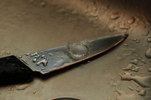 Qaradağ rayonunda gənc oğlan bıçaqlanıb