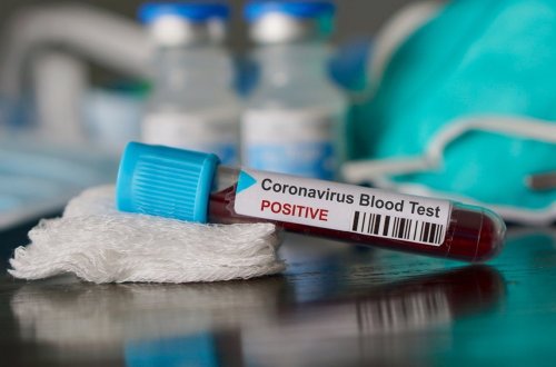 Koronavirusla bağlı ən qorxulu proqnoz gerçək oldu