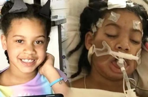 ABŞ-da koronavirusa yoluxan uşaq iflic keçirdi