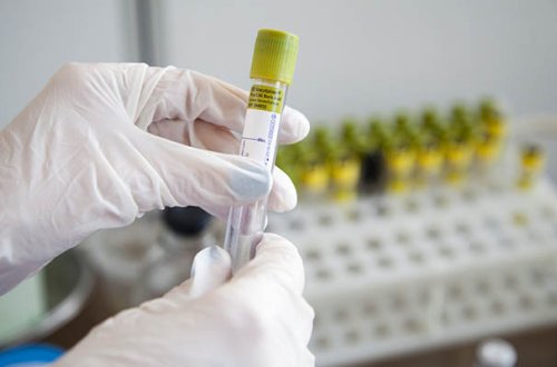 Rusiyada koronavirusun yeni ştamı aşkar olundu