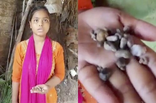 Qızın gözündən yaş əvəzinə daş gəlir - VİDEO