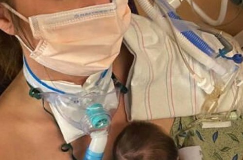 COVID-ə yoluxan hamilə qadın komada ikən uşaq doğdu – Kuryoz