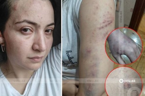 Polis əri tərəfindən şöbədə qətlə yetirilən qadının qardaşı gizlinləri açdı - FOTOLAR