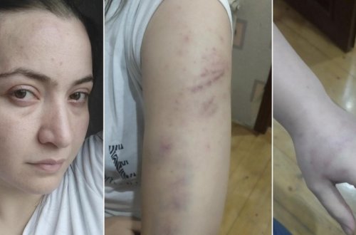 Polis əri tərəfindən güllələnərək öldürülən qadının övladlarının kimin qəyyumluğuna veriləcəyi məlum olub