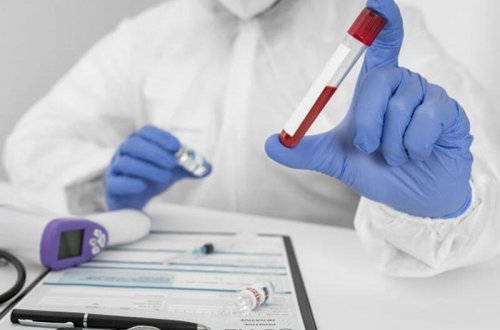 Ölkə üzrə COVID-19-a yoluxma statistikası açıqlandı