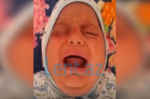 Azərbaycanda gözlərindən qan gələn uşaqla bağlı YENİ XƏBƏR - 
