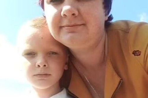 Ərinə xəyanət edən qadın oğlunu yandırdı: Hər şeyi atasına dediyi üçün - FOTOLAR