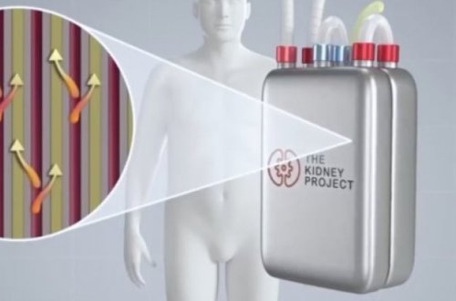 Süni böyrək yaradılır - YENİ KƏŞF