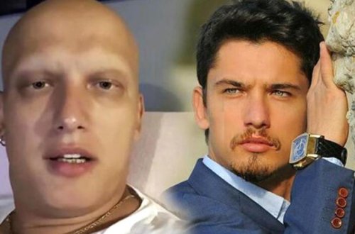 Xərçənglə mübarizə aparan məşhur aktyor səhnəyə qayıdır