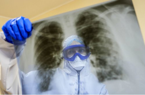 Koronavirusun daha çox zədələdiyi orqanlar AÇIQLANDI