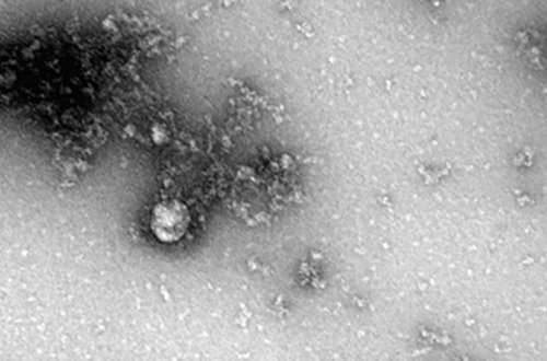 “Delta” ştamının ilk - Fotosu