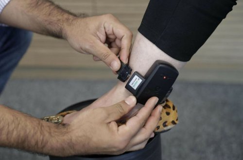 Azərbaycanda ginekoloqa elektron qolbaq taxıldı