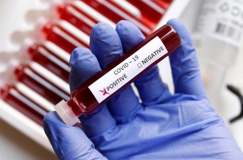 Gürcüstanda daha 46 nəfər COVID-19-dan ölüb