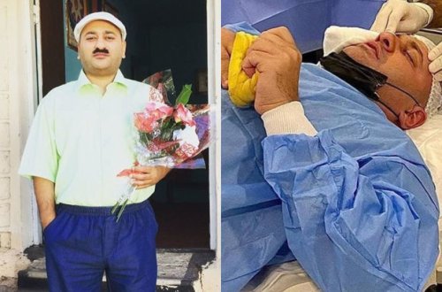 Известный азербайджанский актер перенес операцию - ФОТО