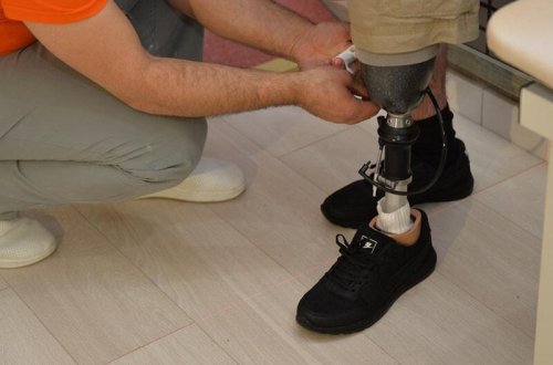 157 qazi yüksək texnologiyalı protezlərlə təmin edilib