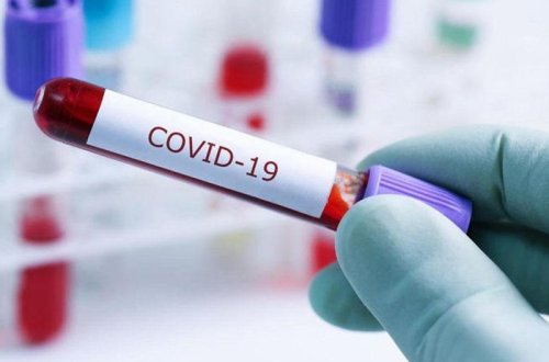 Gürcüstanda son sutkada koronavirusdan 43 nəfər ölüb