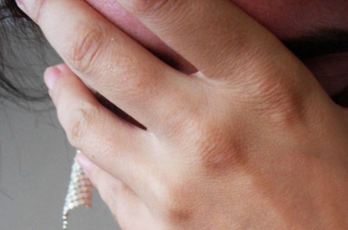 В Сумгайыте молодой женщине плеснули в лицо кислотой