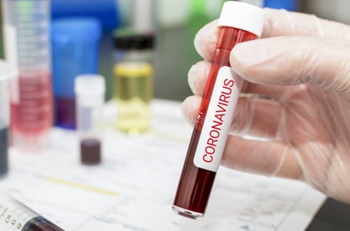 Gürcüstanda COVID-19-a 5 240 yeni yoluxma qeydə alınıb, 68 nəfər ölüb